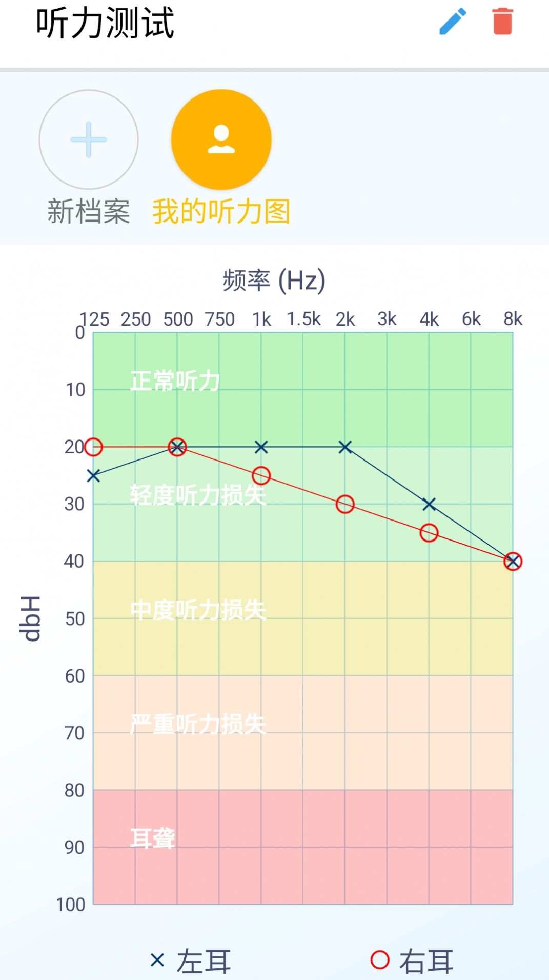 艾米助听下载app安卓版 v1.0